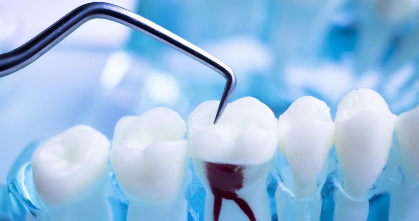 endodoncja