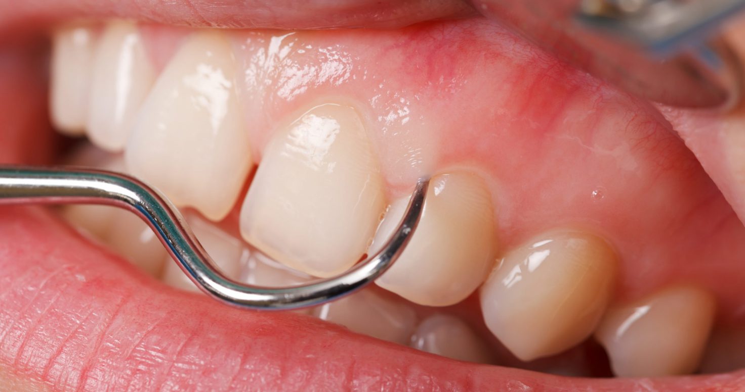 periodontologia